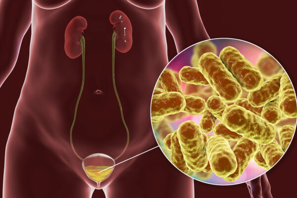 Urology Videos