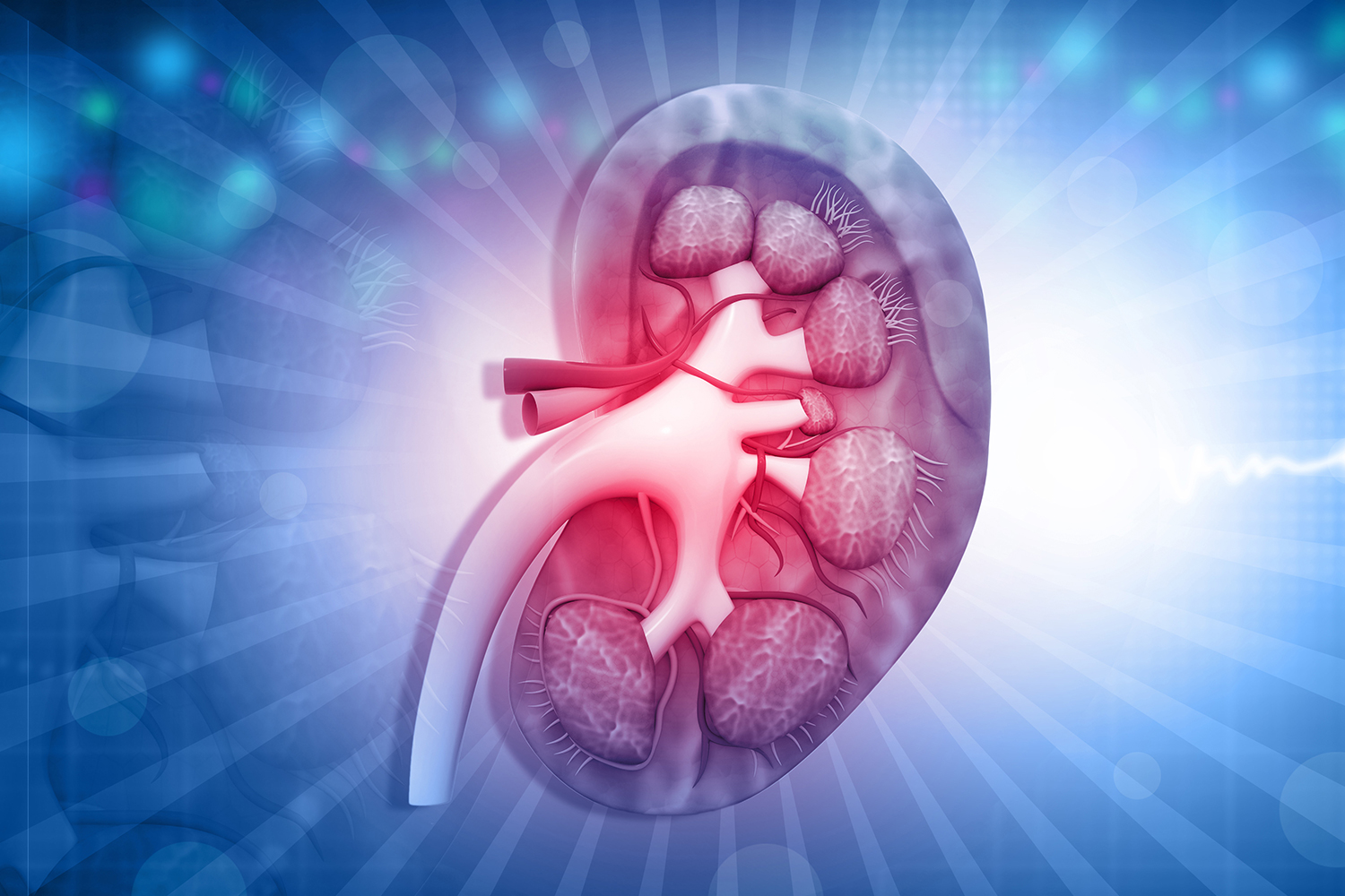 Nephrology Video Kidney Failure Treatment Without Dialysis