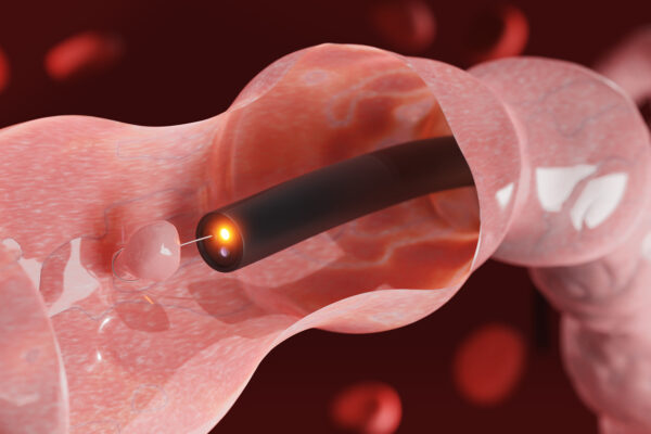Endoscopic Videos