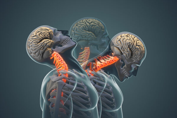 3D Medical Animation Company