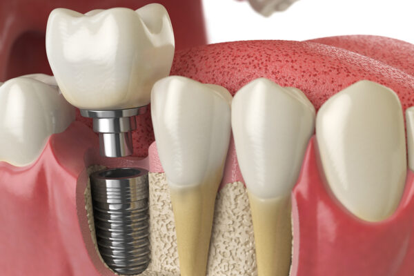 Importance Of Dental Videos