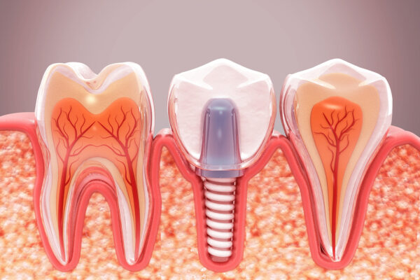 Importance Of Dentistry Videos