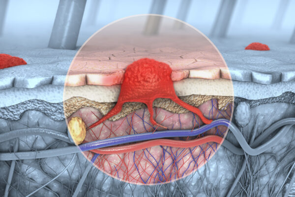 Importance Of Dermatology Videos
