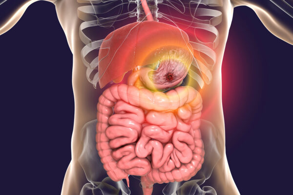 Importance Of Gastroenterology Videos