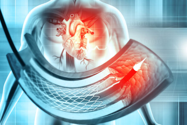 Importance Of General Surgery Videos