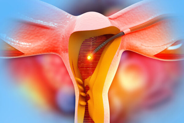 Importance Of Infertility Video