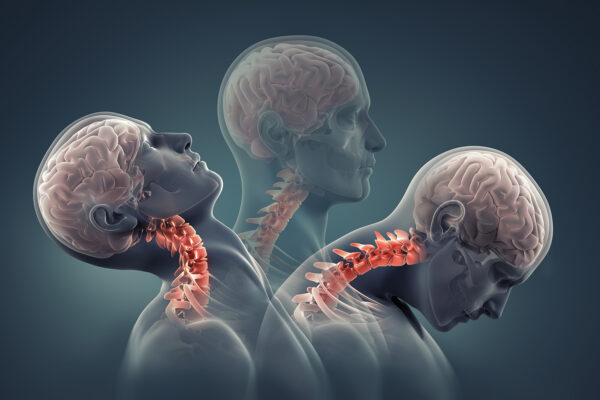 Use Of 3D Videos For Patient Education Advocacy
