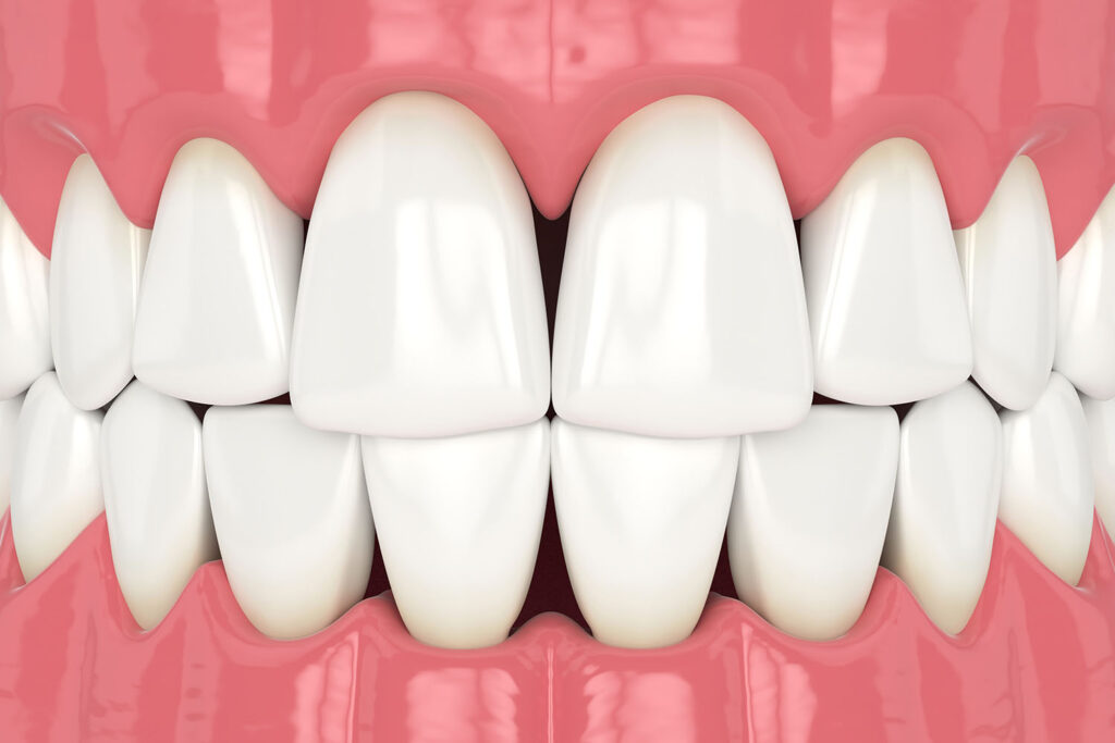 An Overview of Teeth Anatomy and Their Purposes