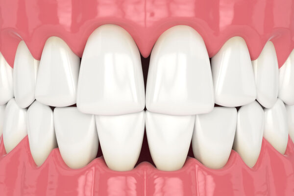 Teeth Anatomy