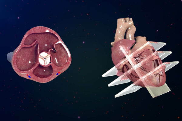 What Is An Echocardiogram
