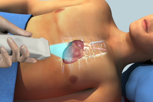 What Does An Echocardiogram Show