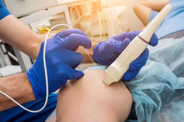 What Is Ablation