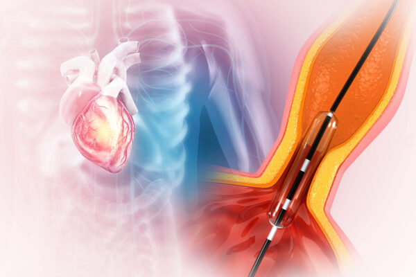 Prostate Biopsy