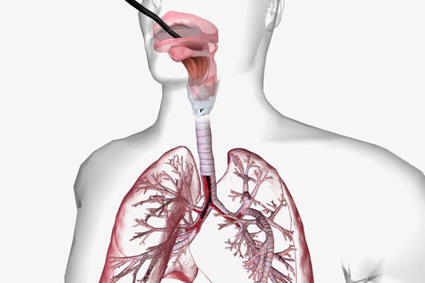 Bronchoscopy