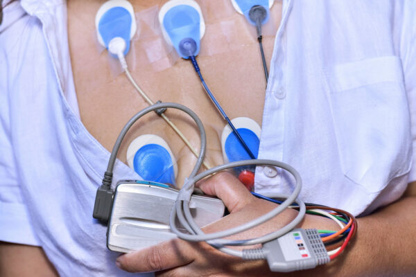 Cardiac Ablation