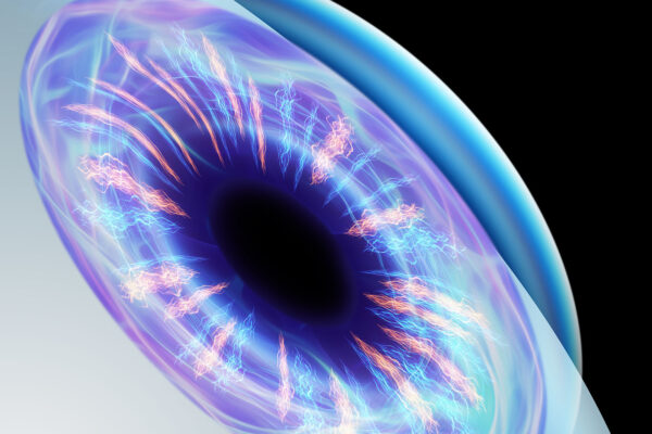 Cornea Transplant