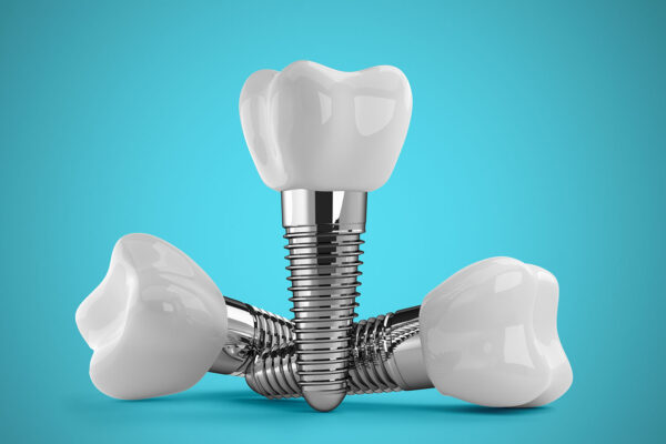 Implant Teeth
