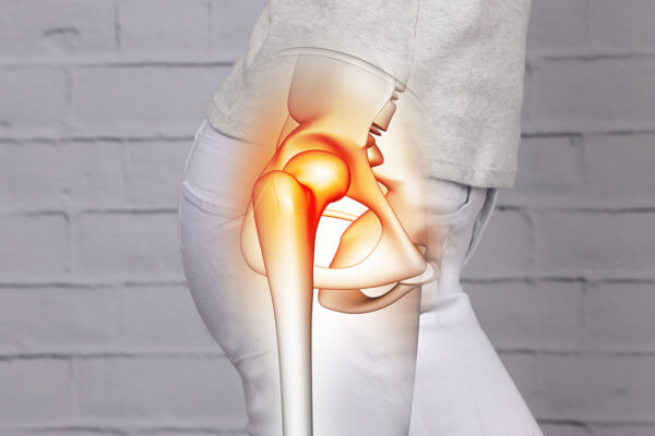 Labrum Tear Hip