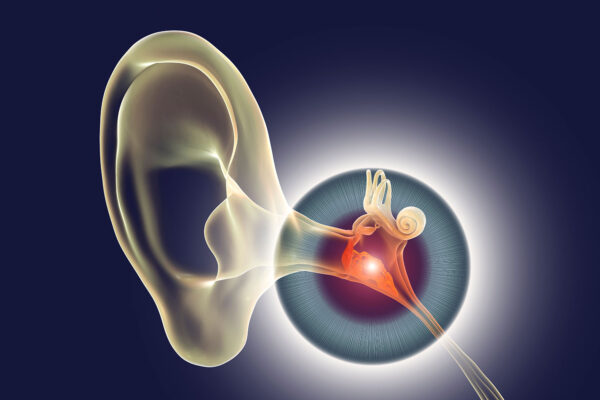 Otitis Media With Effusion