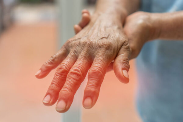 Polyneuropathy