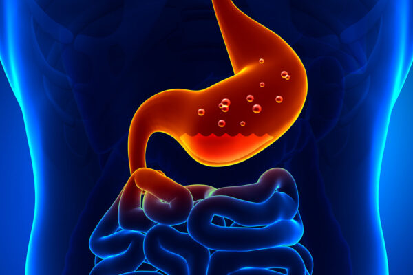 Symptoms Of Gastritis