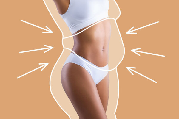 What Is Liposuction