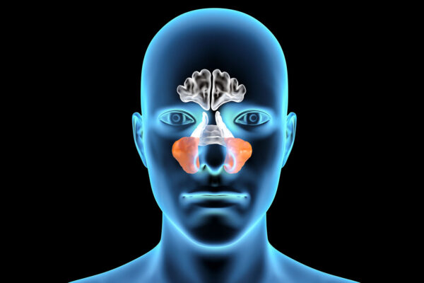 Nose Diagram