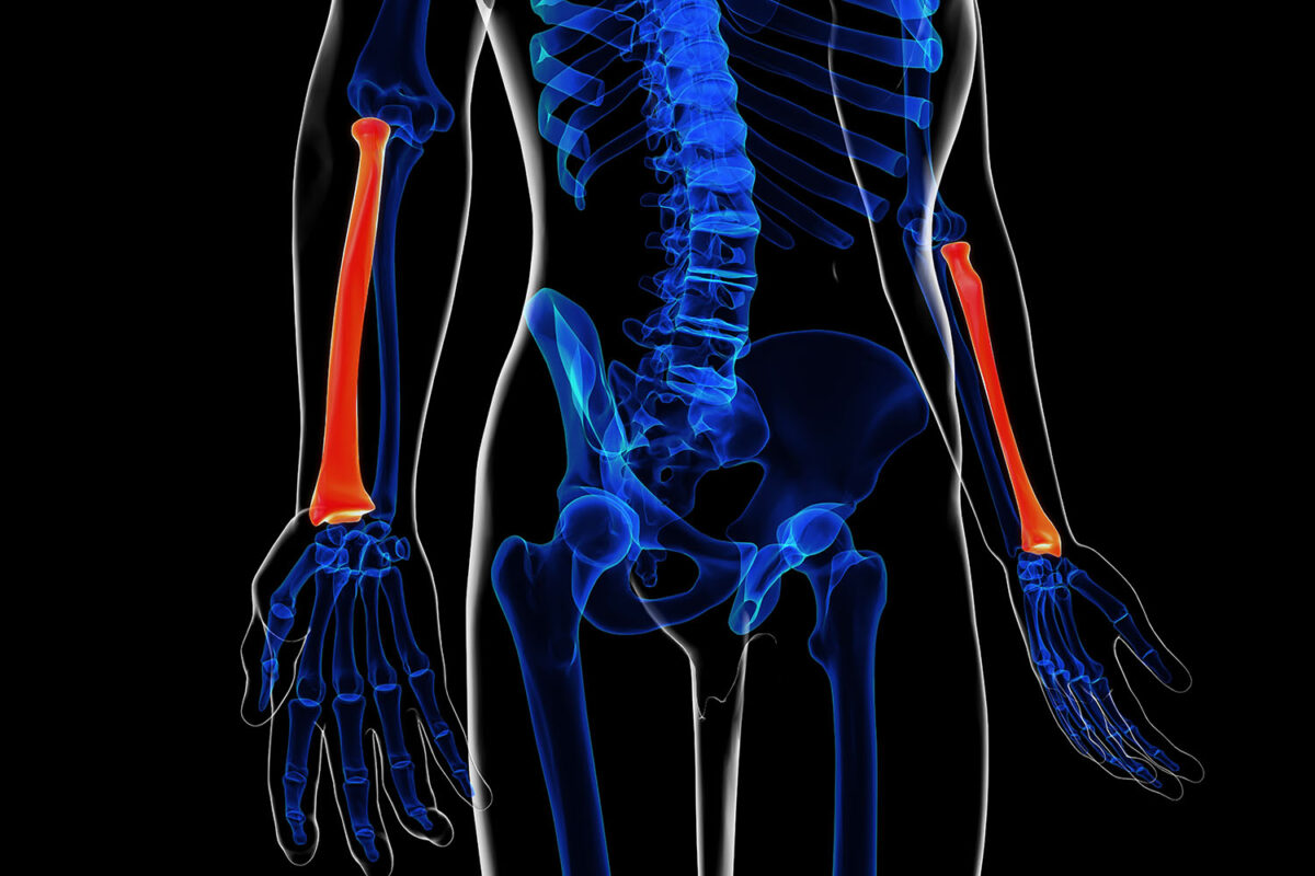 Radius Bone Anatomy - Eremedium