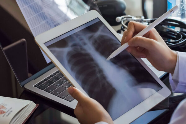 Application Of X Ray