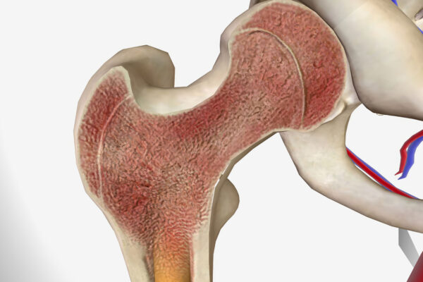 Bone Marrow Aspiration Indications