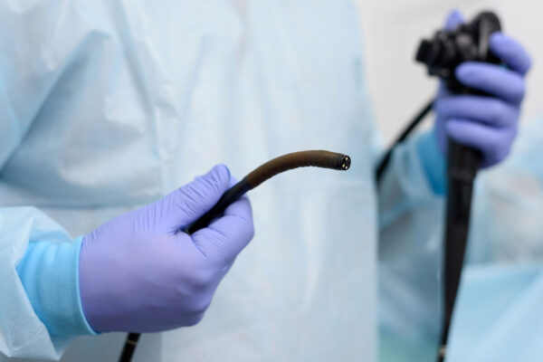 Bronchoscopy Test Price