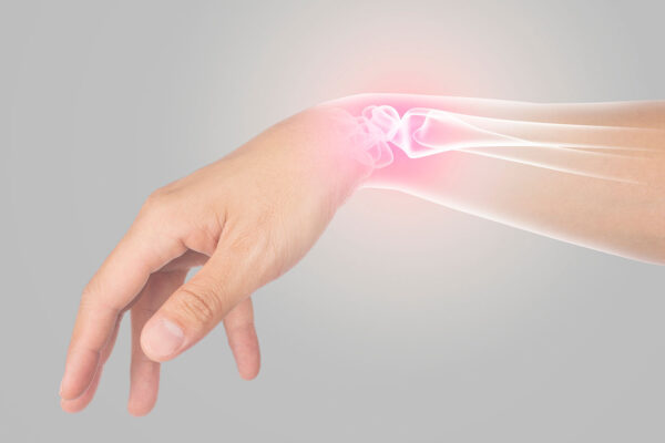 Hand Fracture Photo