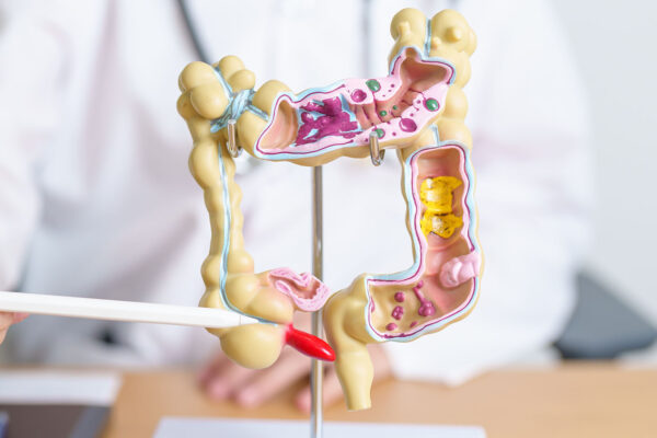 Subacute Appendicitis