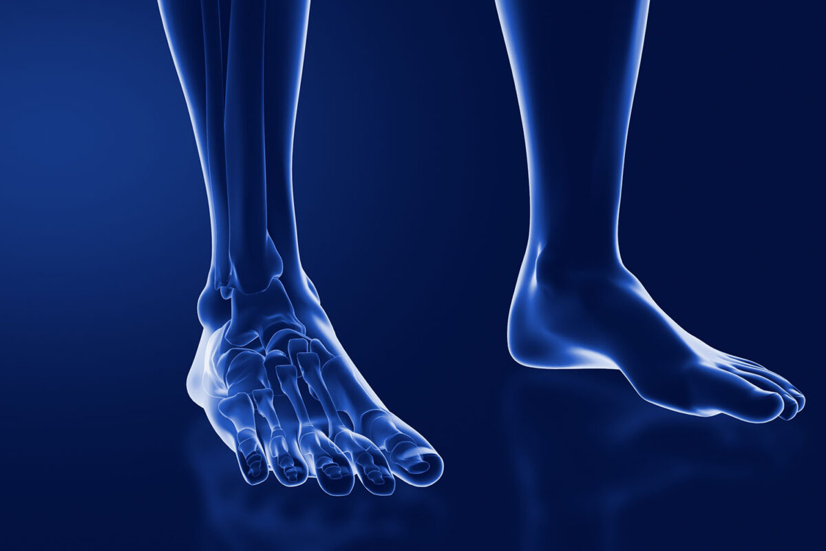 Syndesmosis Joint - Eremedium