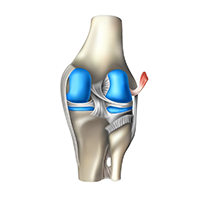 orthopedic