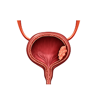 urology